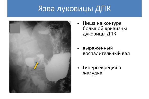 Какой нужен тор чтоб зайти в кракен